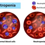 What is Neutropenia?