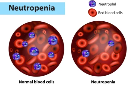 What is Neutropenia?