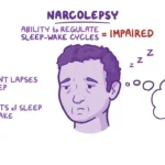 What is Narcolepsy?
