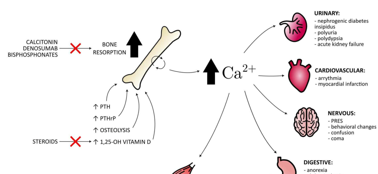 What is Hypercalcemia?