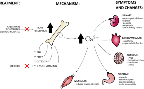 What is Hypercalcemia?