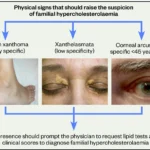 What is Hypercholesterolaemia?