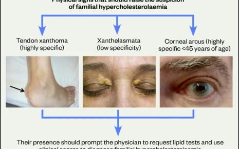 What is Hypercholesterolaemia?
