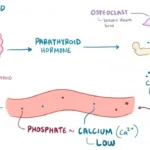 What is Hyperphosphatemia?