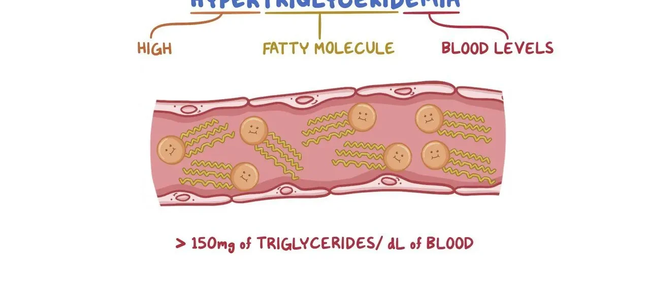 what is Hypertriglyceridemia
