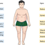 what is Hypogonadism