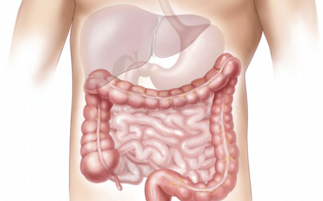 what is Intestinal Disorder