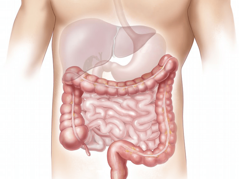 what is Intestinal Disorder