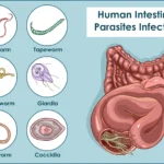 what is Intestinal Parasites