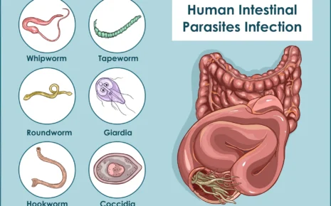 what is Intestinal Parasites