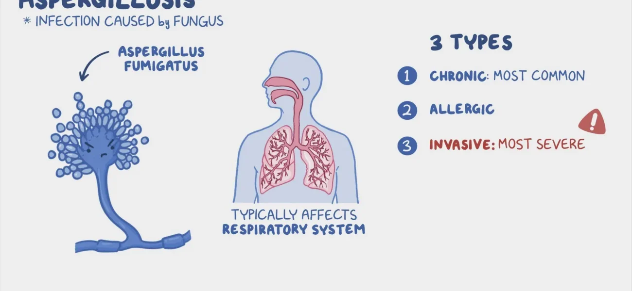 What is Invasive Aspergillosis?