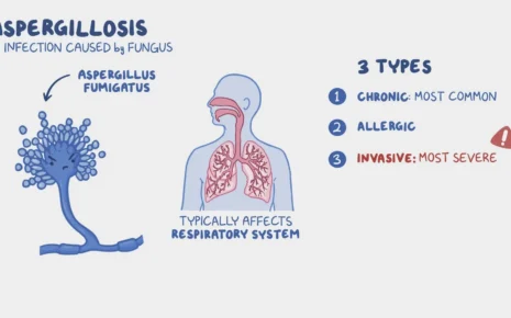 What is Invasive Aspergillosis?