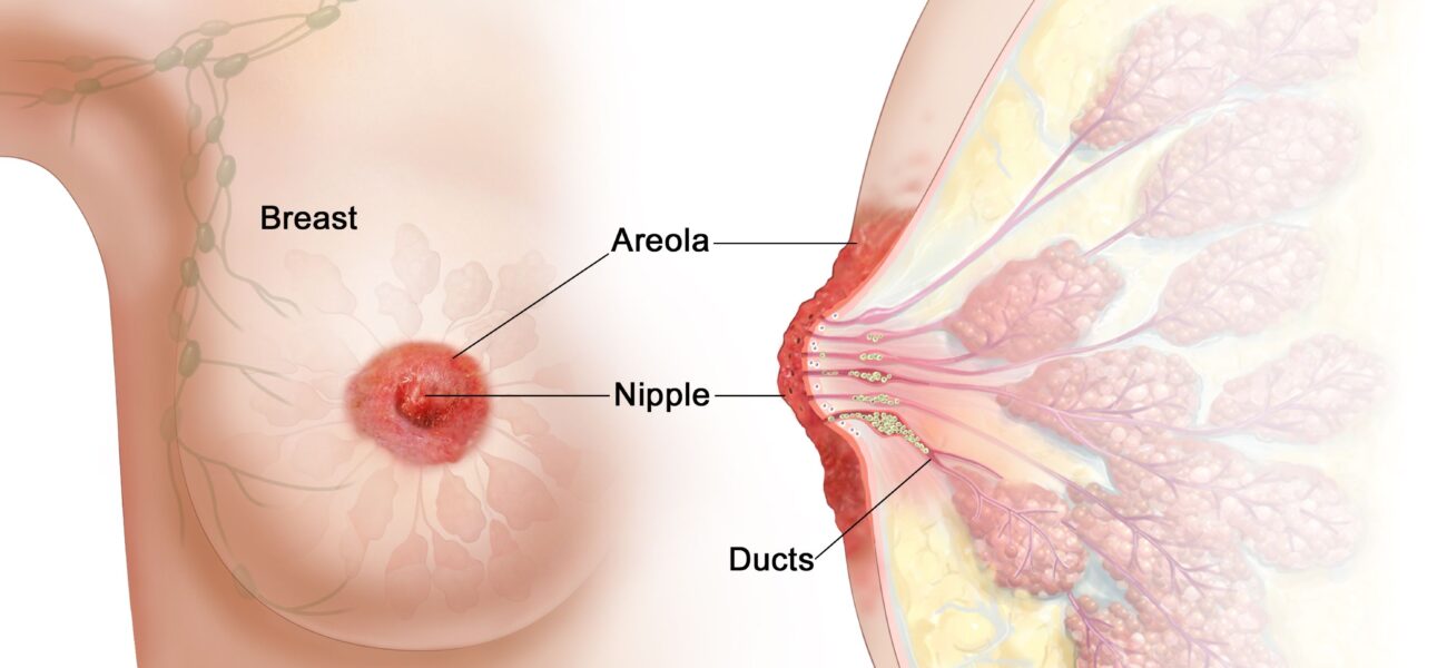 What is Lesions in Paget’s Disease: