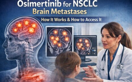 Osimertinib for NSCLC brain metastases