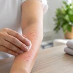 Person gently touching a mild skin rash on their forearm in a calm home setting